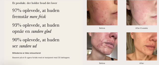 Skin Perfector 2% BHA