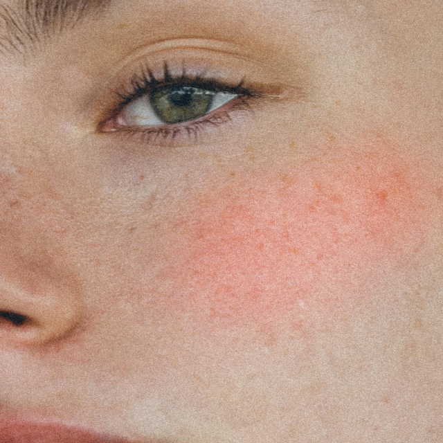 Candy Cream Blush